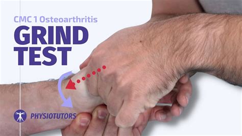 cmc osteoarthritis grind test